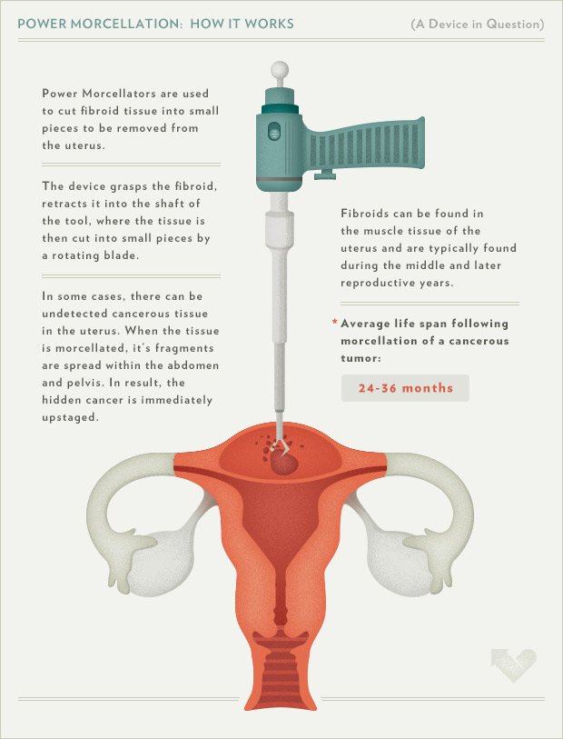 Gynecologic Cancer Awareness Gynecologic Cancer Awareness